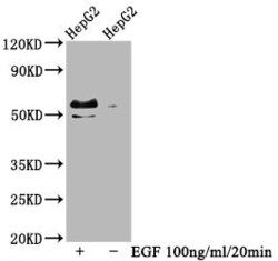 Invitrogen Phospho-c-Myc (Thr58, Ser62) Recombinant Rabbit Monoclonal Antibody