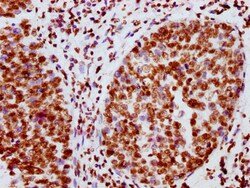 Invitrogen Phospho-JAK2 (Tyr1007, Tyr1008) Recombinant Rabbit Monoclonal