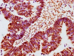 Invitrogen Phospho-JAK2 (Tyr1007, Tyr1008) Recombinant Rabbit Monoclonal