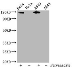 Invitrogen Phospho-JAK2 (Tyr1007, Tyr1008) Recombinant Rabbit Monoclonal