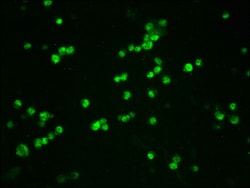 Invitrogen Phospho-beta Catenin (Ser33, Ser37) Recombinant Rabbit Monoclonal