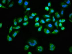 Invitrogen Phospho-AKT1 (Ser473) Recombinant Rabbit Monoclonal Antibody