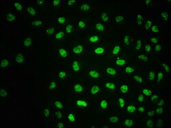 Invitrogen Phospho-ATM (Ser1981) Recombinant Rabbit Monoclonal Antibody