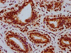 Invitrogen Phospho-Rb (Ser780) Recombinant Rabbit Monoclonal Antibody (2E9)