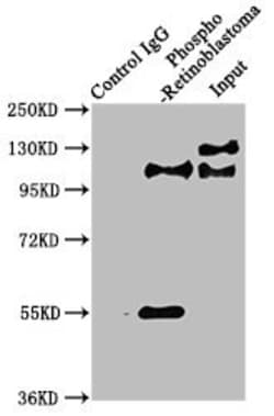 Invitrogen Phospho-Rb (Ser780) Recombinant Rabbit Monoclonal Antibody (2E9)