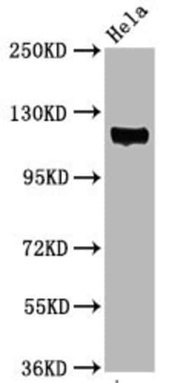 Invitrogen Phospho-FAK (Tyr397) Recombinant Rabbit Monoclonal Antibody (1B3) 100 &mu;L | Buy Online | Invitrogen&trade; | Fisher Scientific