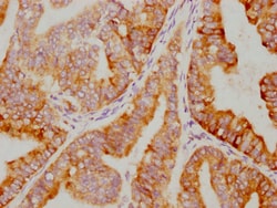 Invitrogen IkB alpha Recombinant Rabbit Monoclonal Antibody (1E9) 100 &mu;L;