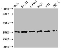 Invitrogen IkB alpha Recombinant Rabbit Monoclonal Antibody (1E9) 100 &mu;L;