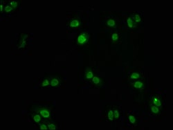Invitrogen FOXO3A Recombinant Rabbit Monoclonal Antibody (1E2) 100 &mu;L;