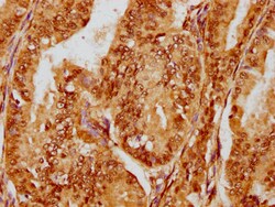 Invitrogen FOXO3A Recombinant Rabbit Monoclonal Antibody (1E2) 100 &mu;L;