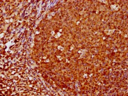 Invitrogen FOXO3A Recombinant Rabbit Monoclonal Antibody (1E2) 100 &mu;L;
