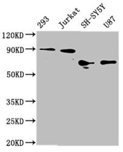 Invitrogen FOXO3A Recombinant Rabbit Monoclonal Antibody (1E2) 100 &mu;L;