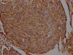 Invitrogen Filamin A Recombinant Rabbit Monoclonal Antibody (1B2) 100 &mu;L;
