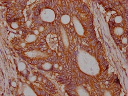 Invitrogen c-Met Recombinant Rabbit Monoclonal Antibody (2D12) 100 &mu;L;