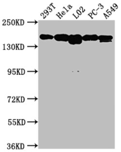 Invitrogen c-Met Recombinant Rabbit Monoclonal Antibody (2D12) 100 &mu;L;