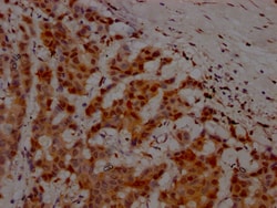 Invitrogen ATM Recombinant Rabbit Monoclonal Antibody (3G11) 100 &mu;L;