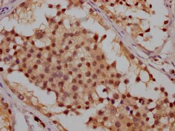 Invitrogen ATM Recombinant Rabbit Monoclonal Antibody (3G11) 100 &mu;L;