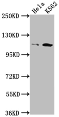 Invitrogen PIK3CB Recombinant Rabbit Monoclonal Antibody (5A9) 100 &mu;L;