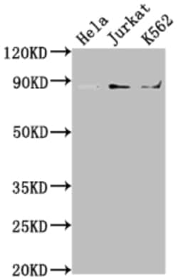 IKK beta Recombinant Rabbit Monoclonal Antibody (5D12), Invitrogen 100