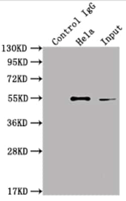 Invitrogen ILK Recombinant Rabbit Monoclonal Antibody (6A5) 100 &mu;L;