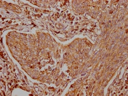 Invitrogen TRAF2 Recombinant Rabbit Monoclonal Antibody (9A5) 100 &mu;L;