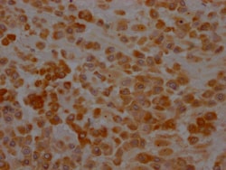 Invitrogen SERPINH1 Recombinant Rabbit Monoclonal Antibody (10B2) 100 &mu;L;