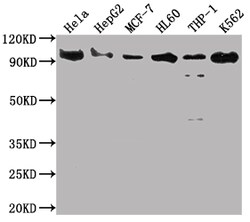 Invitrogen SUZ12 Recombinant Rabbit Monoclonal Antibody (1B10) 100 &mu;L;