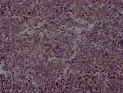 Invitrogen EZH2 Recombinant Rabbit Monoclonal Antibody (2C7) 100 &mu;L;