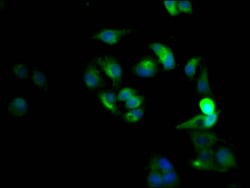 Invitrogen CXCR4 Recombinant Rabbit Monoclonal Antibody (2F10) 100 &mu;L;