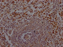 Invitrogen Neutrophil elastase Recombinant Rabbit Monoclonal Antibody (2H12)