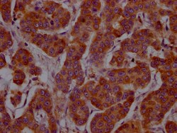 Invitrogen IL-4 Recombinant Rabbit Monoclonal Antibody (5D8) 100 &mu;L;