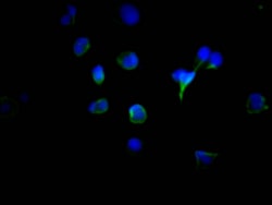 Invitrogen Tyrosinase Recombinant Rabbit Monoclonal Antibody (6B2) 100