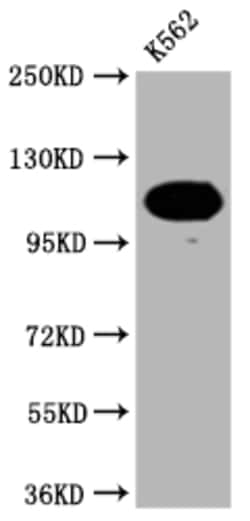 Invitrogen PARP1 Recombinant Rabbit Monoclonal Antibody (8C7) 100 &mu;L;