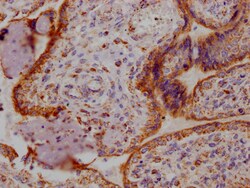 Invitrogen Angiopoietin 2 Recombinant Rabbit Monoclonal Antibody (1F10)