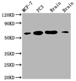 Invitrogen LOXL2 Recombinant Rabbit Monoclonal Antibody (2E5) 100 &mu;L | Buy Online | Invitrogen&trade; | Fisher Scientific