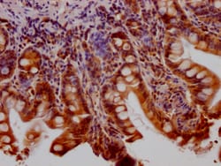 Invitrogen Huntingtin Recombinant Rabbit Monoclonal Antibody (6F2) 100