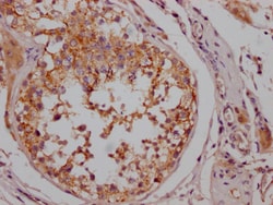 Invitrogen B-Raf Recombinant Rabbit Monoclonal Antibody (6G3) 100 &mu;L;