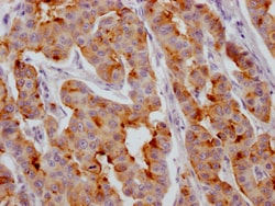 Invitrogen IGFBP2 Recombinant Rabbit Monoclonal Antibody (7G11) 100 &mu;L;