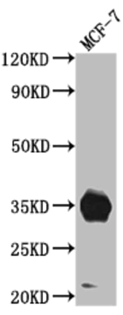 Invitrogen IGFBP2 Recombinant Rabbit Monoclonal Antibody (7G11) 100 &mu;L;
