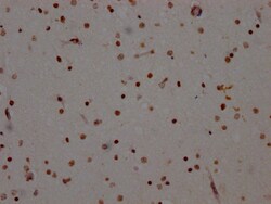 Invitrogen ADAR1 Recombinant Rabbit Monoclonal Antibody (7H12) 100 &mu;L;