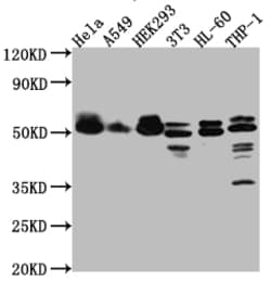 Invitrogen MAPKAPK2 Recombinant Rabbit Monoclonal Antibody (4G7) 100 &mu;L;