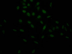 Invitrogen HIF1A Recombinant Rabbit Monoclonal Antibody (5D12) 100 &mu;L;
