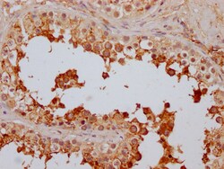 Invitrogen FAAH Recombinant Rabbit Monoclonal Antibody (8G3) 100 &mu;L;