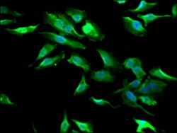Invitrogen GSK3B Recombinant Rabbit Monoclonal Antibody (9G11) 100 &mu;L;