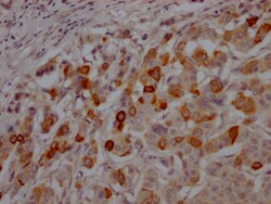Invitrogen GSK3B Recombinant Rabbit Monoclonal Antibody (9G11) 100 &mu;L;