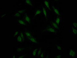 Invitrogen RNF20 Recombinant Rabbit Monoclonal Antibody (2H12) 100 &mu;L;