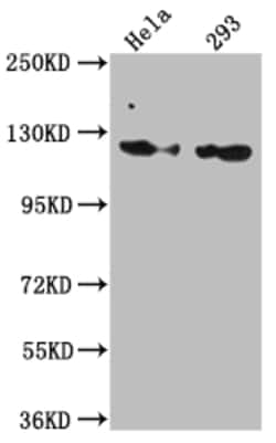 Invitrogen RNF20 Recombinant Rabbit Monoclonal Antibody (2H12) 100 &mu;L;