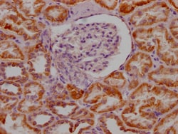 Invitrogen MAOA Recombinant Rabbit Monoclonal Antibody (4C11) 100 &mu;L;