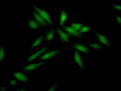Invitrogen SKP2 Recombinant Rabbit Monoclonal Antibody (6D4) 100 &mu;L | Buy Online | Invitrogen&trade; | Fisher Scientific