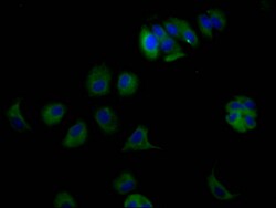 Invitrogen ErbB3 Recombinant Rabbit Monoclonal Antibody (6F6) 100 &mu;L;